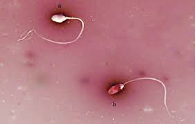 Sperm Vitality Kit