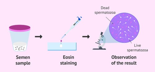 Sperm Vitality Kit - Image 2