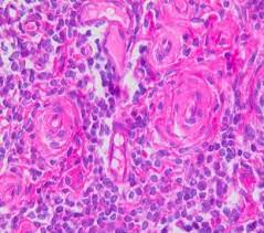 Hematoxylin Harris
