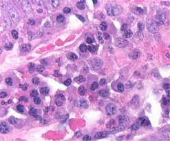 Hematoxylin Harris